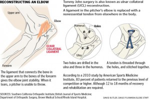 Tommy John Procedure Dr John Skedros