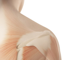 Image of shoulder musculature used to explain orthopedic surgery.